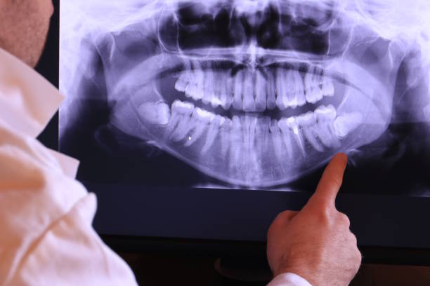Best Emergency Denture Repair in St Joseph, MN