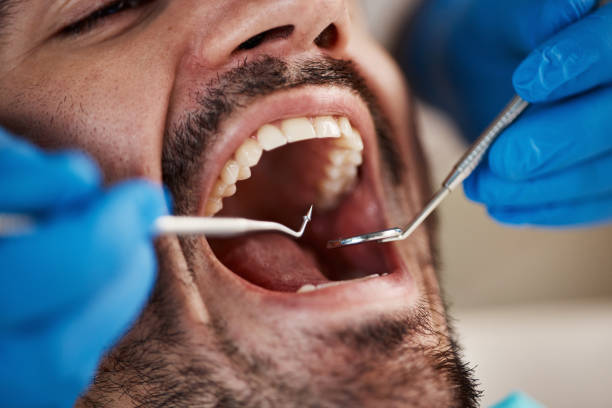 Best Emergency Care for Gum Disease in St Joseph, MN