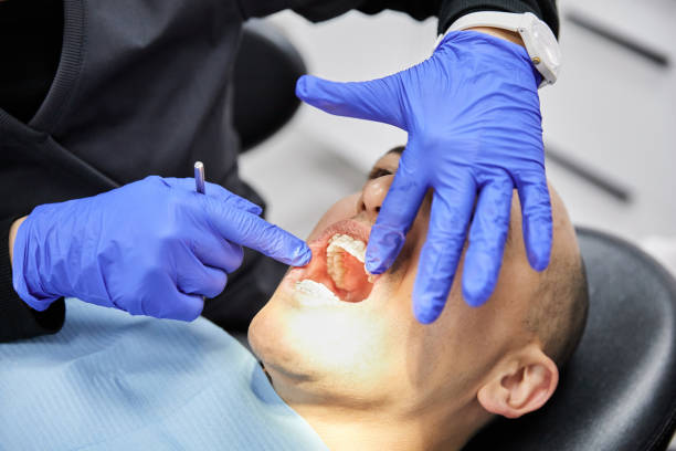 Best Broken or Chipped Tooth Repair in St Joseph, MN